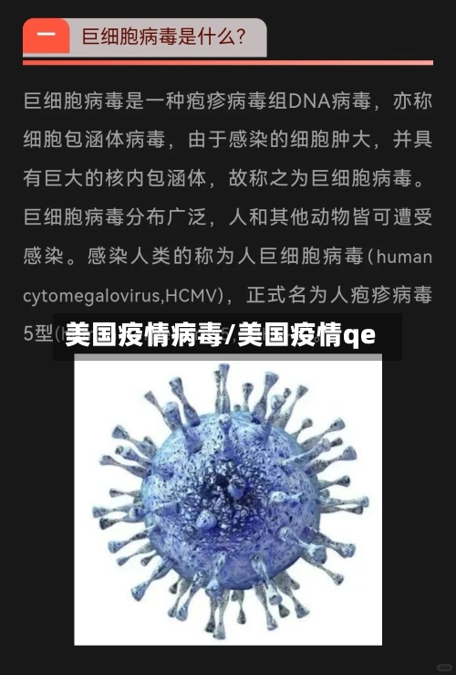 美国疫情病毒/美国疫情qe-第3张图片