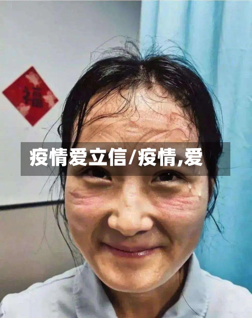 疫情爱立信/疫情,爱-第2张图片