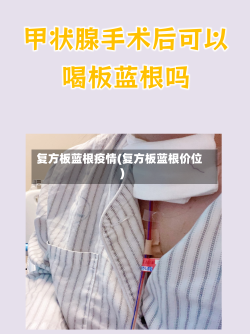 复方板蓝根疫情(复方板蓝根价位)-第2张图片