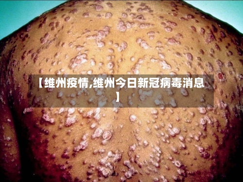 【维州疫情,维州今日新冠病毒消息】