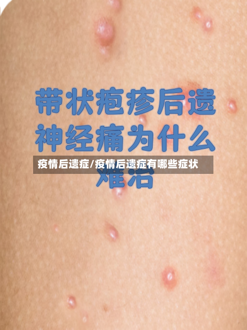疫情后遗症/疫情后遗症有哪些症状